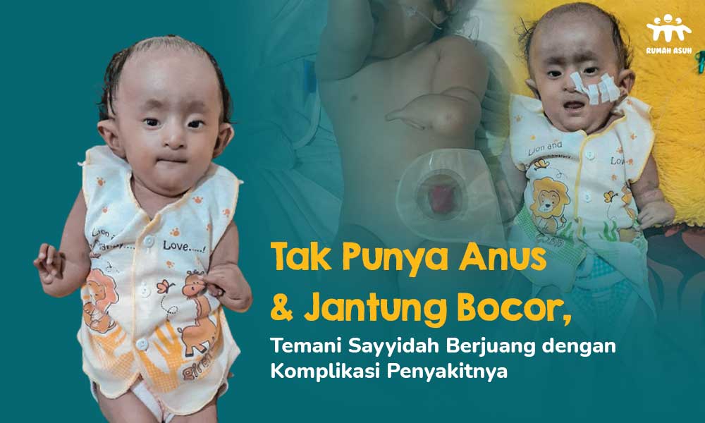 Buang Air Besar Lewat Perut, Sayyidah Butuh Operasi Pembuatan Anus