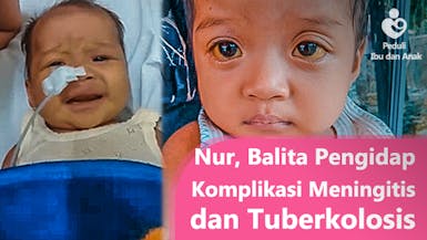 Nur, Balita dengan Komplikasi Meningitis dan Tuberkolosis