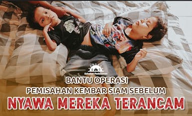 5 Tahun Syafaat dan Hidayah Bertahan Hidup Dengan Kondisi Kembar Siam