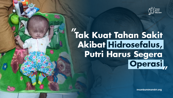 Kepala Terus Membesar, Bantu Putri Sembuh dari Penyakit Hidrosefalus