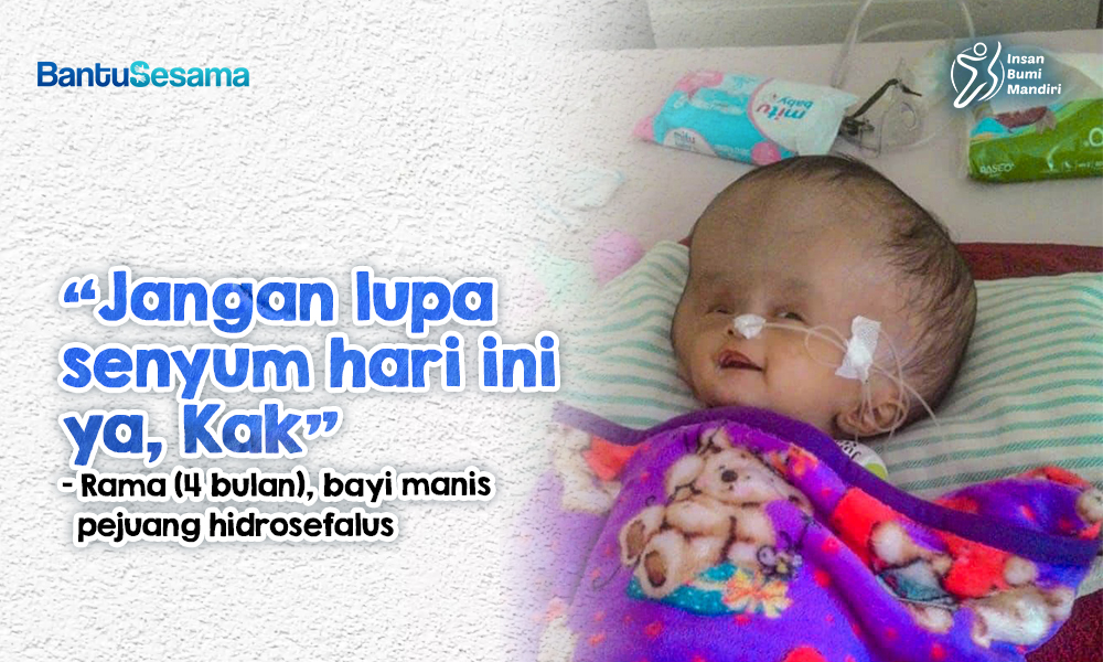 Temani Bayi Rama Sembuh dari Hidrosefalus