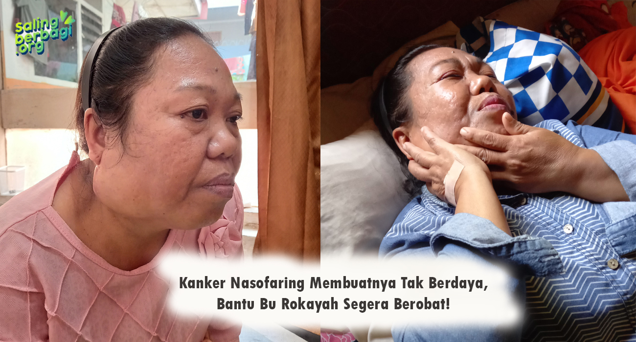 Kanker Nasofaring Membuatnya Tak Berdaya, Bantu Bu Rokayah Segera Berobat!