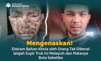 Bantu Bawa Pak Chandra Operasi Kornea Mata