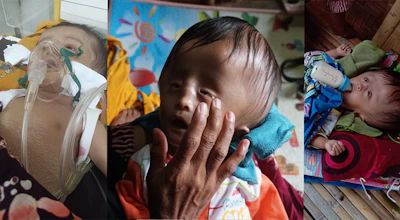 Tangis Bayi 5 Bulan Menahan Sakit Kepala Yang Membesar