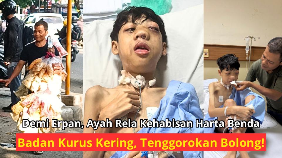 Urgent! Bantu Anak Penjual Kerupuk Sembuh!
