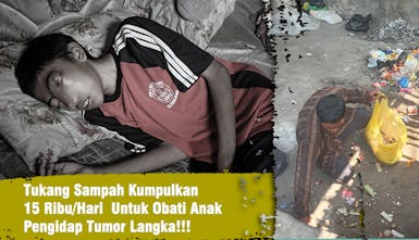 Anak Tukang Sampah Idap Tumor Sinonasal : Sampai Sulit Bernafas!