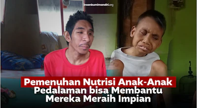 Gizi Buruk Mengancam Masa Depan Anak-Anak Pedalaman