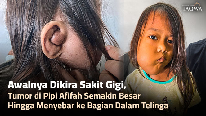 Bantu Sembuhkan Afifah dari Tumor Pipi dan Telinga