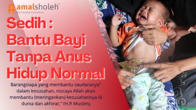Bantu Bayi Tanpa Anus Agar Hidup Normal