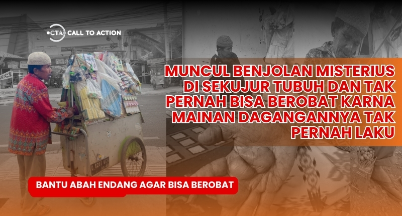 Tolong Pak Endang yang Tubuhnya Dipenuhi Benjolan dan Harus Menafkahi Keluarga yang Sakit