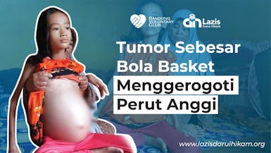 Tumor Sebesar Bola Basket Menggerogoti Perut Anggi