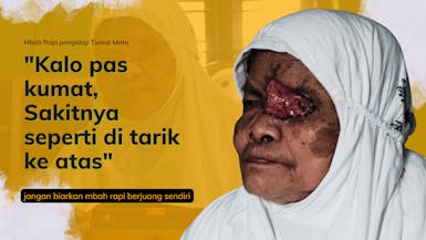 Tak Pernah Berobat, Tumor Bikin 1 Mata Mbah Bolong