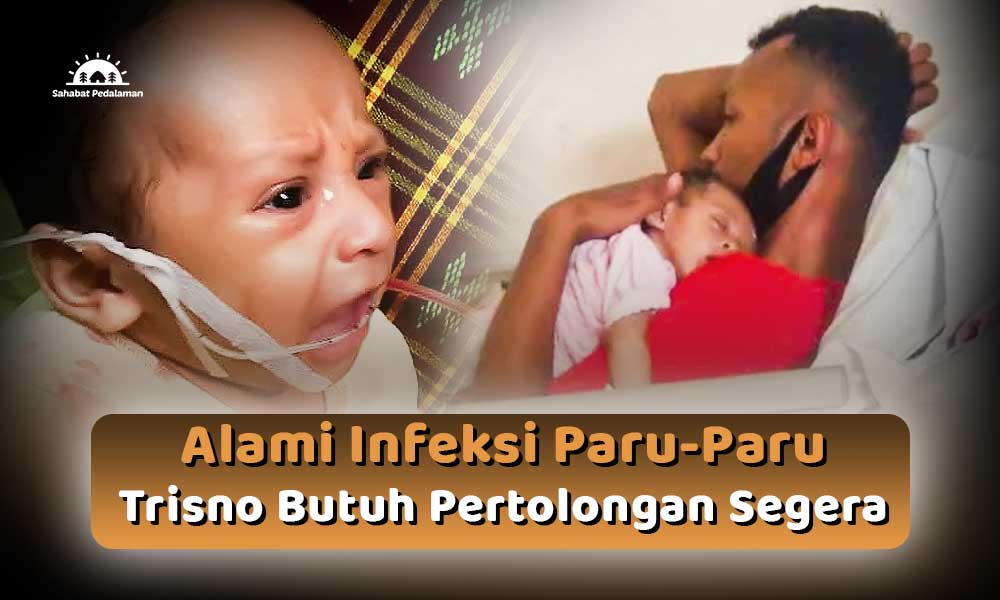 Al-Trisno, Bayi 5 Bulan Pejuang Infeksi Paru-Paru