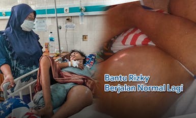 Derita Kanker Tulang, Bantu Pengobatan Rizky Supaya Bisa Berjalan Lagi
