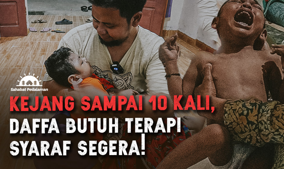 Tetanus Buat Kepala Daffa Mengecil dan Epilepsi