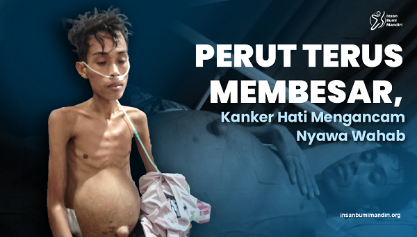 Perut Terus Membesar, Kanker Hati Mengancam Nyawa Wahab