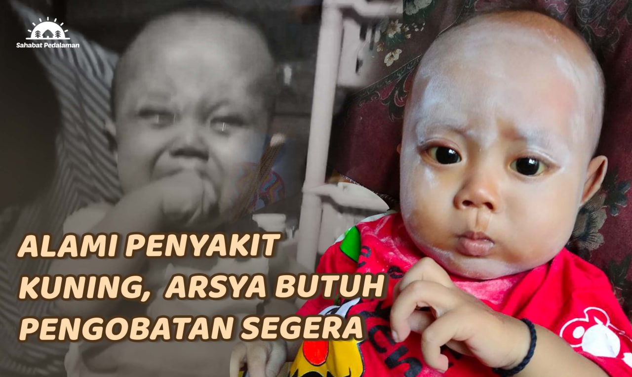 Bantu Arsya Sembuh dari Penyakit Kuning