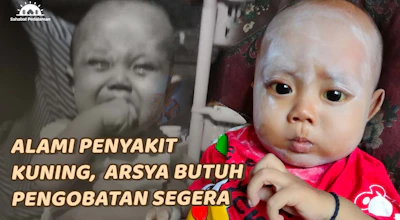 Bantu Arsya Sembuh dari Penyakit Kuning