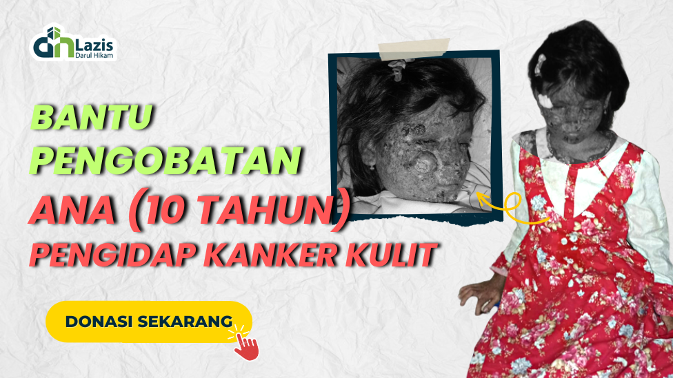 URGENT!!! BANTU PENGOBATAN ANAK PENJUAL JAGUNG MANIS YANG MENDERITA KANKER KULIT!!