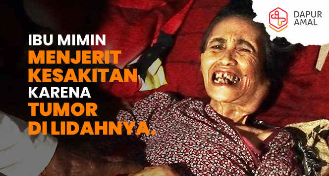 Ibu Mimin Menjerit Kesakitan Karena Tumor di Lidahnya
