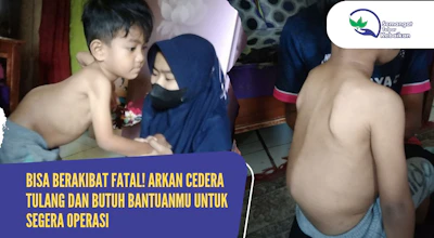 Arkan (4th), Anak Tukang Las dan Guru Ngaji Ini Cedera Tulang Hingga Risiko Lumpuh