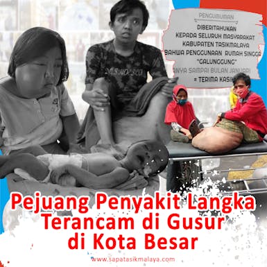 Pejuang Penyakit Langka Terancam di Gusur di Rumah Singgah!!