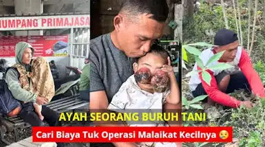 TOLONG! Terancam Buta! Bantu Ruhi Lekas Operasi Tumor Ganas
