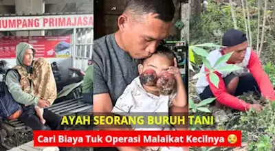 TOLONG! Terancam Buta! Bantu Ruhi Lekas Operasi Tumor Ganas