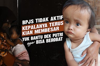Tak Punya Biaya Berobat, Bantu Kembalikan Harapan Dek Putri untuk Sembuh