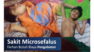 Sakit Microsefalus, Farhan Butuh Pengobatan