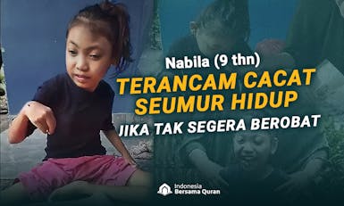 Terancam Lumpuh Seumur Hidup, Bantu Nabila Sembuh dari Epilepsi dan Pengecilan Otak Bagian Belakang