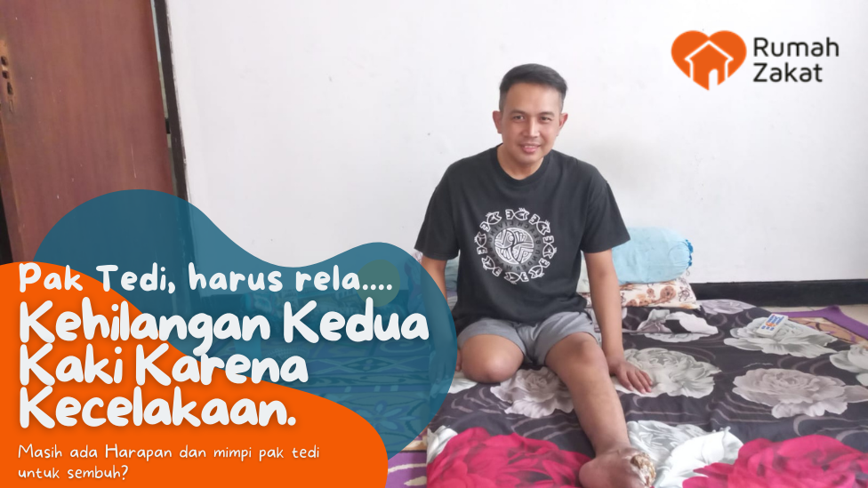 Kaki Palsu untuk Pejuang Nafkah