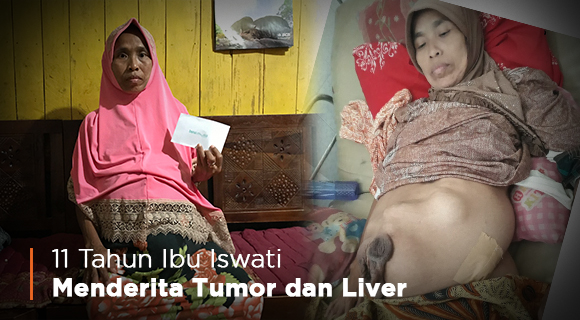 Sembuhkan Tumor dan Liver Ibu Iswati