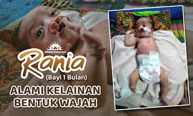 Rania Alami Kelainan Bentuk Wajah