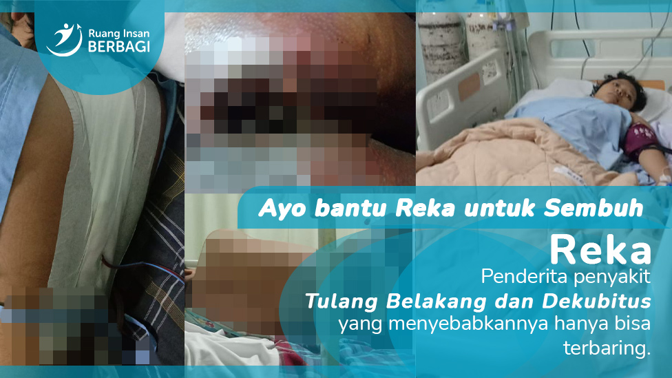 Tuberkulosis Terus Menggerogoti Punggung, Bantu Reka Untuk Sembuh