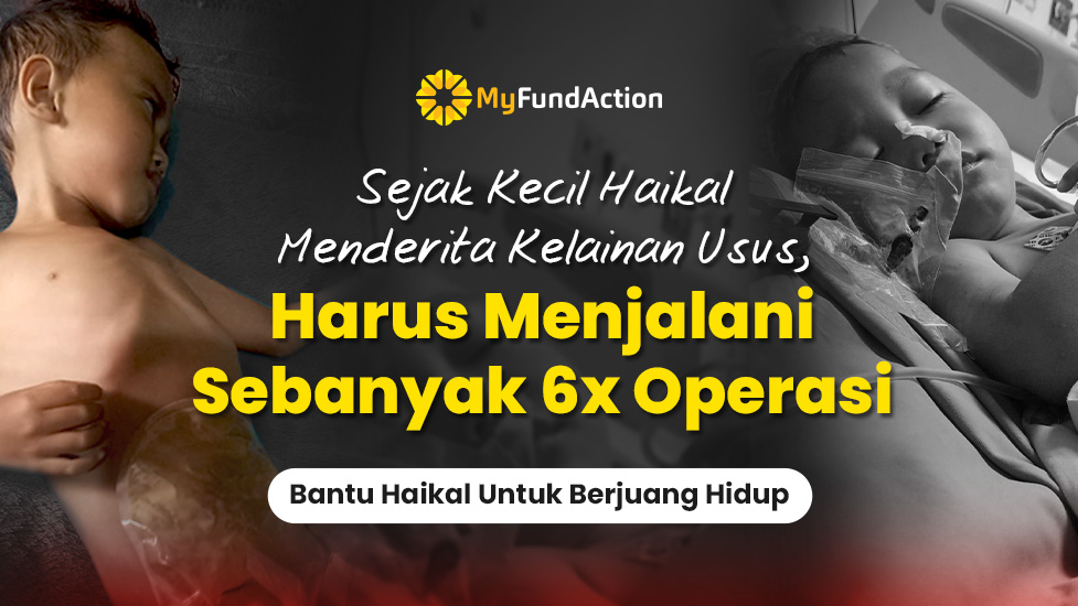 Pengobatan Operasi Terancam Berhenti, Bantu Lanjutkan Haikal Sembuh Kelainan Usus