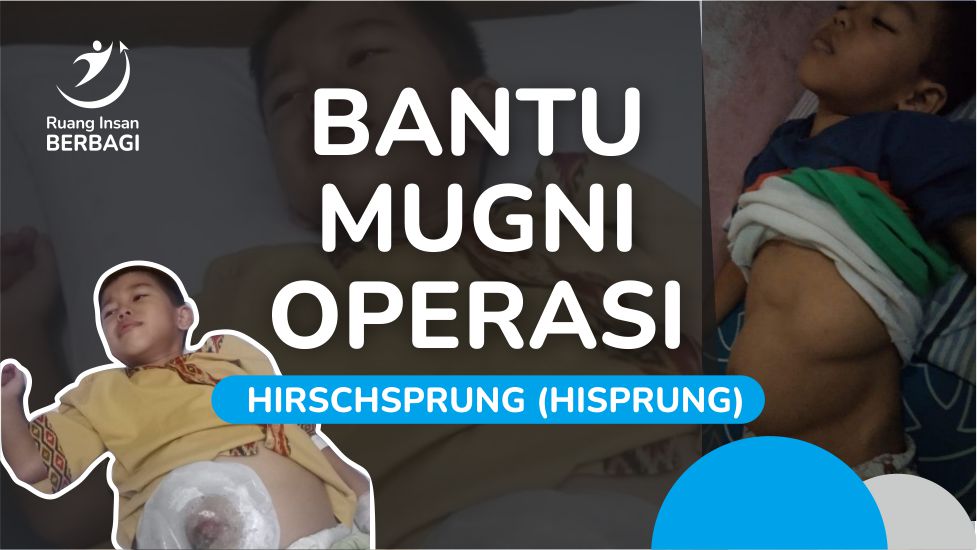 Mari Kembalikan Kebahagiaan Mugni - Bantu Operasi Hirscprung