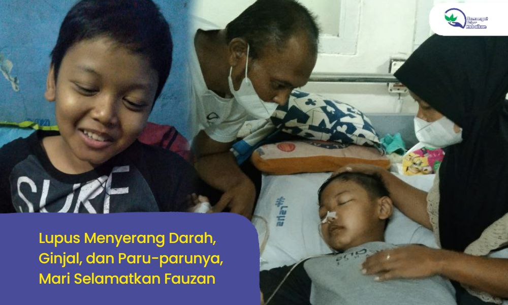 Genting! Lupus Mengancam Nyawa Fauzan