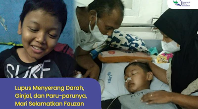 Genting! Lupus Mengancam Nyawa Fauzan