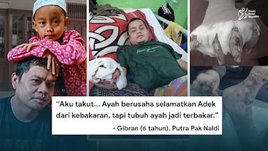 Selamatkan Anak dari Kebakaran, 80% Badan Pak Naldi Kena Luka Bakar