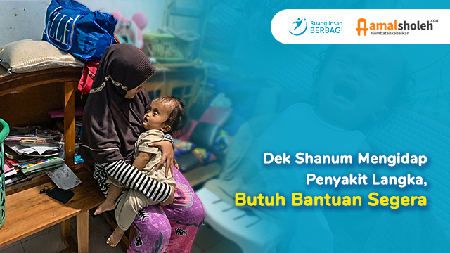 Dek Shanum Mengidap Penyakit Langka, Butuh Bantuan Segera