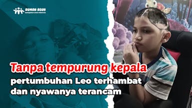 Tempurung Kepala Pecah, Bantu Leo Bertahan!