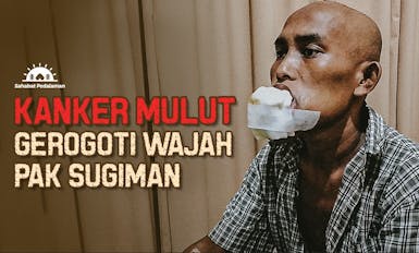 Pak Sugiman, Buruh Tani Berjuang Melawan Kanker Mulut