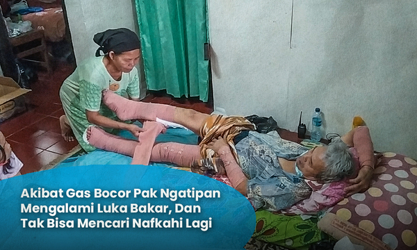 TERKENA GAS MELEDAK, PAK NGATIPAN MENGALAMI LUKA BAKAR PARAH