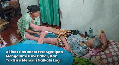 TERKENA GAS MELEDAK, PAK NGATIPAN MENGALAMI LUKA BAKAR PARAH