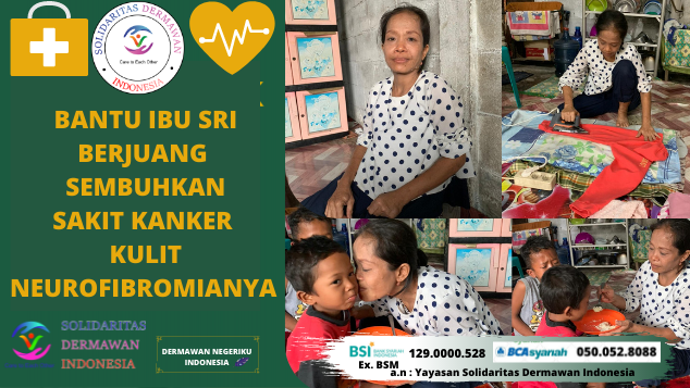 Bantu Solidaritas Bu Sri Rezeki Sembuhkan Sakit Neurofobrimia