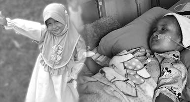 Kelebihan Cairan di Kepala, Renggut Keceriaan Bunga