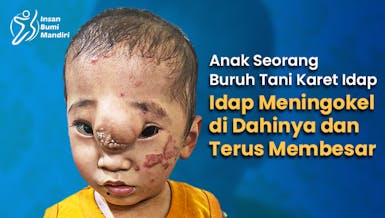Beri Dukungan untuk Sembuhkan Erix dari Benjolan Besar di Kepalanya