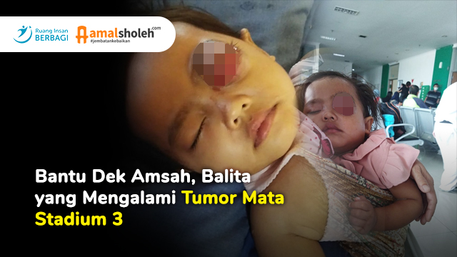 Asmah Fitriani, Penderita Tumor Mata Stadium 3